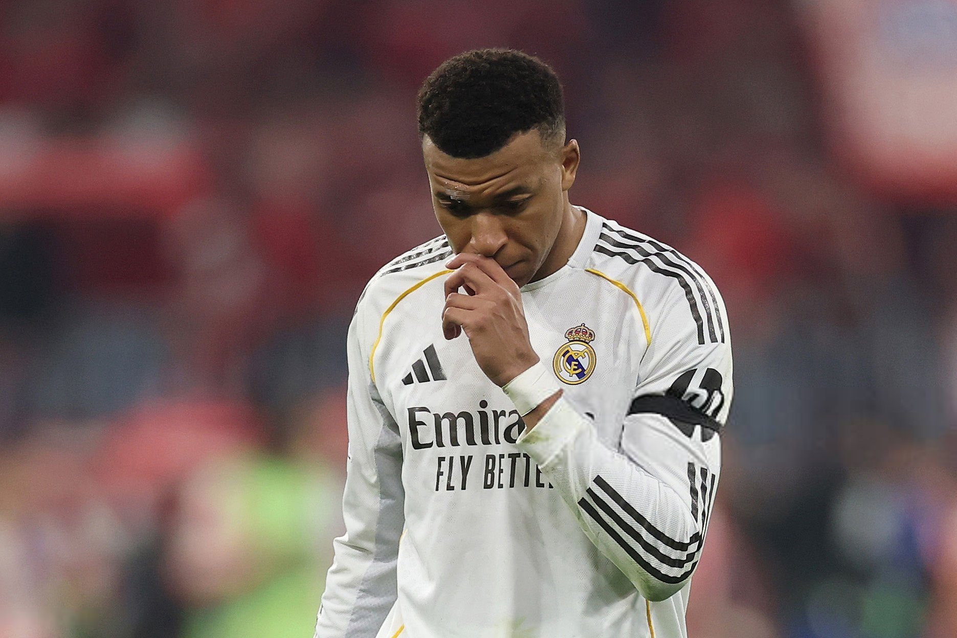 ريال مدريد يكشف عن طبيعة إصابة مبابي